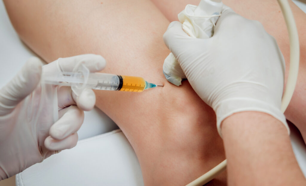 Prolozone Therapy Injection