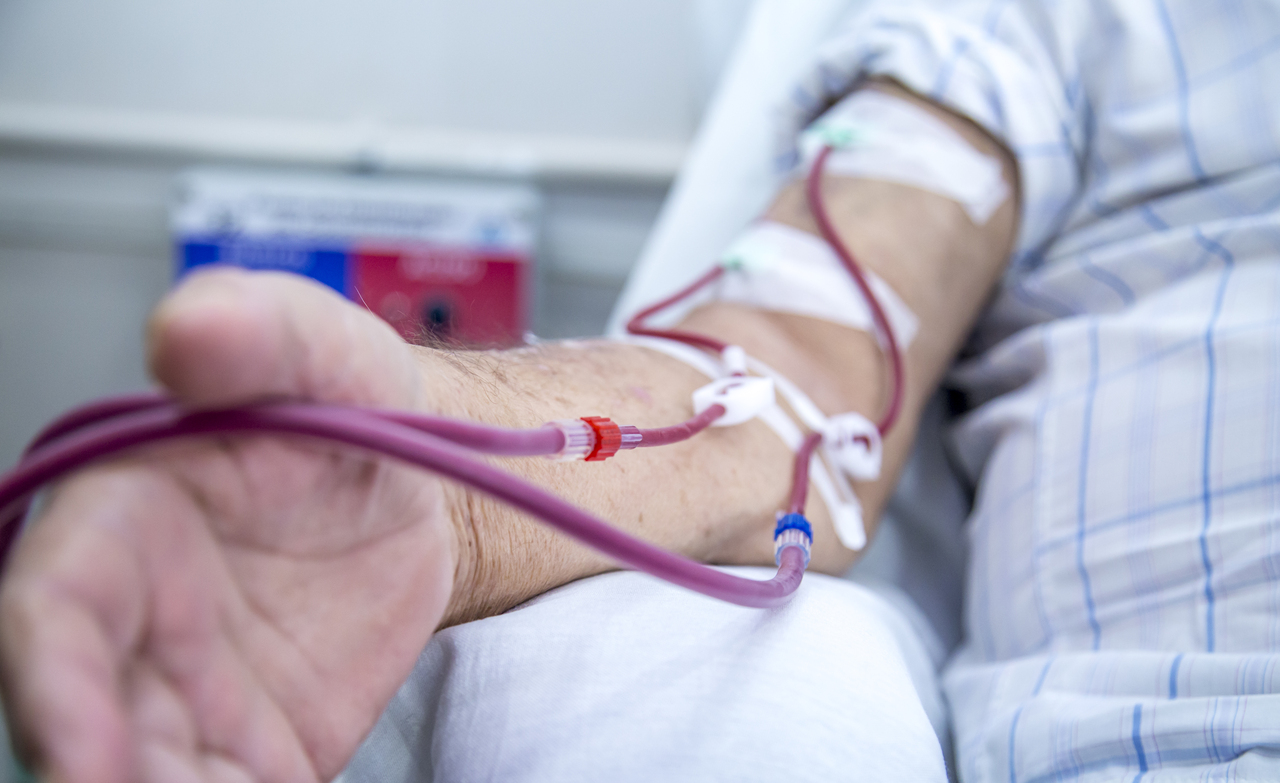 A man undergoing hemodialysis