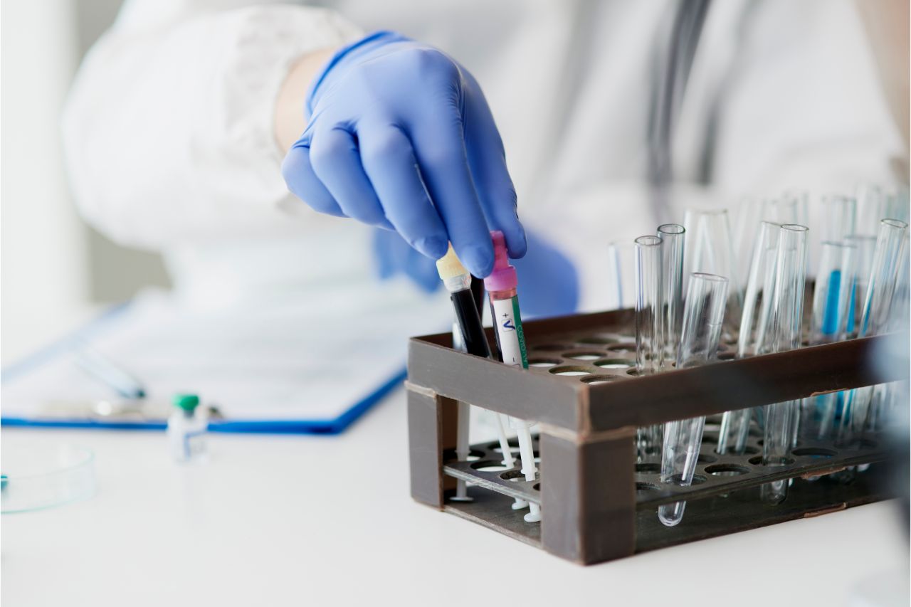 A doctor doing lab tests