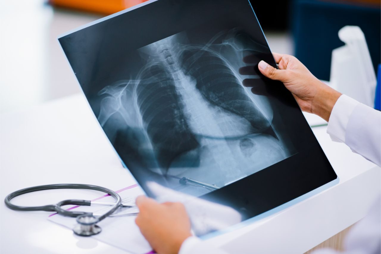 Radiology doctor examining at chest and heart x ray