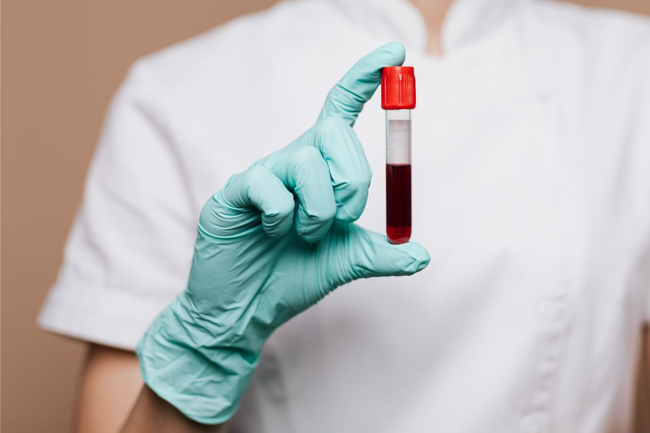 Lipid Blood Test