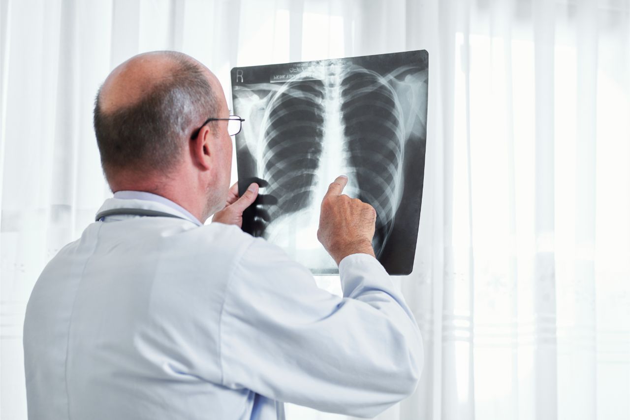 4 Signs Of Lung Cancer