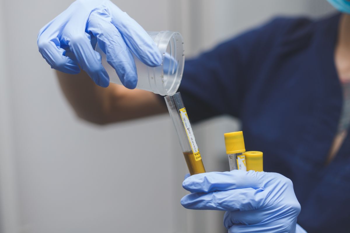 Diagnosis of End Stage Renal Disease